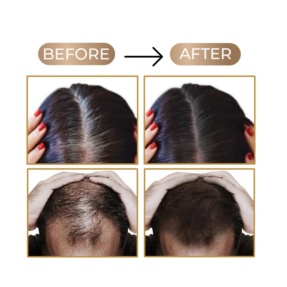 Hair Line Powder Black| Instantly Fuller Looking Hair(40g)