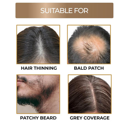 Hair Line Powder Black| Instantly Fuller Looking Hair(40g)